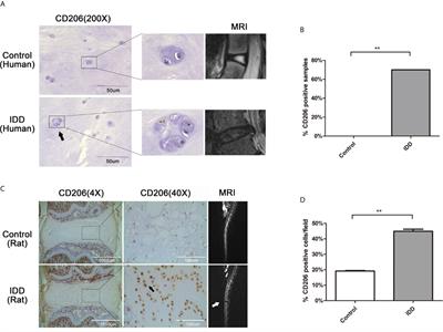 M2a Macrophage-Secreted CHI3L1 Promotes Extracellular Matrix Metabolic Imbalances via Activation of IL-13Rα2/MAPK Pathway in Rat Intervertebral Disc Degeneration